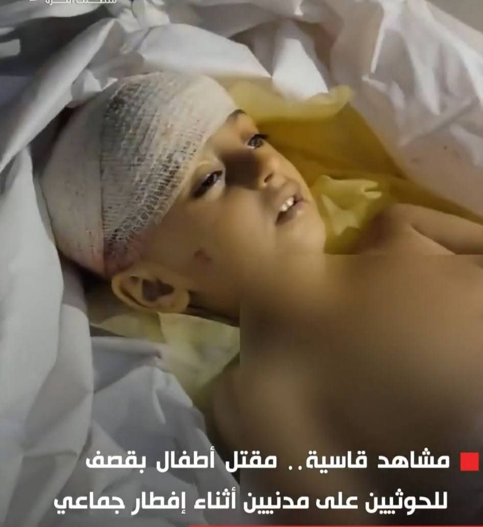 The Yemeni Center for the Rehabilitation of Victims of Violations and Torture “Will & Hope” Condemns the Horrific Massacre Against Civilians in Hajjah Governorate